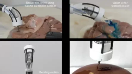 ՏԵՍԱՆՅՈՒԹ. Ստեղծել են ռոբոտ, որը կարող է կենդանի բջիջներ տպել անմիջապես մարդու օրգանիզմում