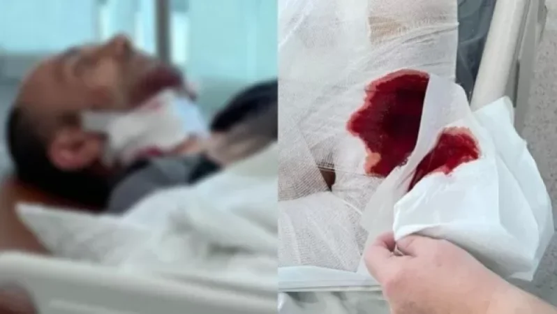 18+. PHOTOS. One person dead, three in moderate condition, names revealed. Artsakh Ombudsman publishes photos