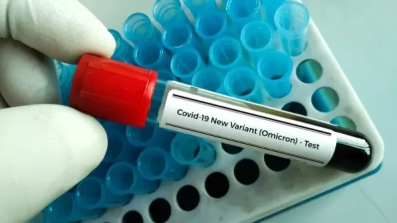 «Օմիկրոն» շտամն արդեն Ռուսաստանում է. վարակման դեպքեր կան