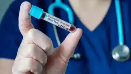 Կորոնավիրուսային իրավիճակը Հայաստանում․ քանի դեպք է հաստատվել այսօր