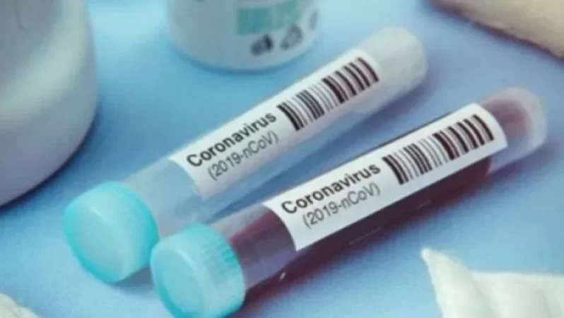 Կորոնավիրուսի այսօրվա տվյալները