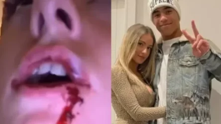 ՏԵՍԱՆՅՈՒԹ. Մանչեսթերի ֆուտբոլիստը նախկին ընկերուհուն ծեծելու և բռնաբարելու համար ձերբակալվել է. աղջիկը տեսանյութ է հրապարակել