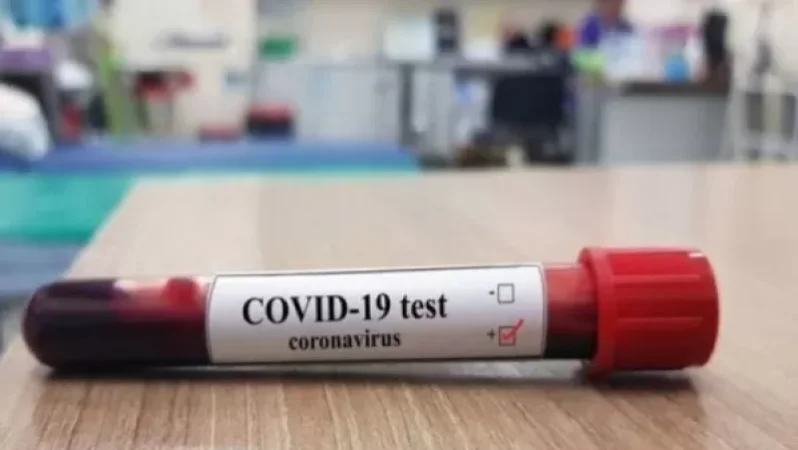 Կորոնավիրուսային իրավիճակը՝ Արցախում