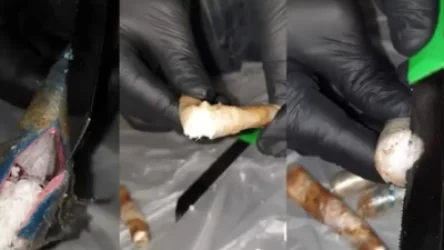 ՏԵՍԱՆՅՈՒԹ․ Տղամարդու մարմնում 5 փաթեթ թմրանյութ են հայտնաբերել