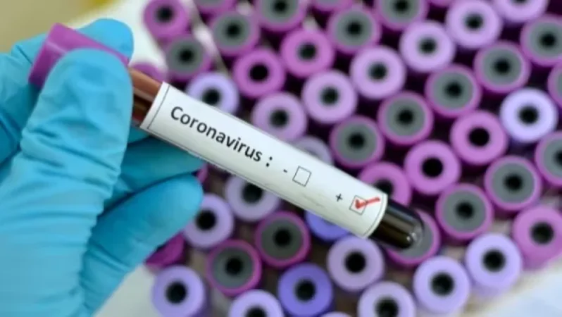 Իրանում կորոնավիրուսով վարակման 13 նոր դեպք է գրանցվել