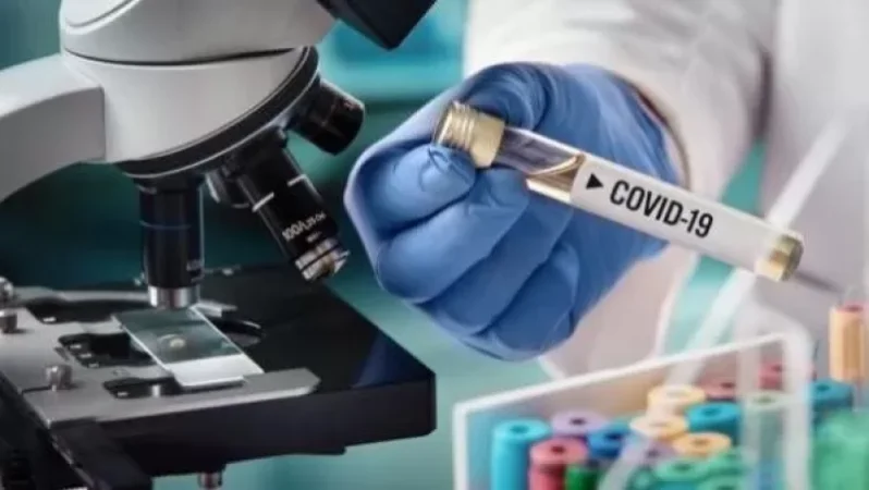 ԹԱՐՄԱՑՎԱԾ. Հունիսի 28-ի դրությամբ՝ վարակման 736 նոր դեպք, 205 ապաքինված, 6 մահ