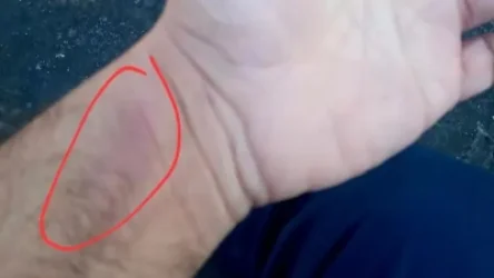 «Քիչ առաջ Գյումրիում պարեկը քաշքշել է ծառայության ընթացքում 2 ոտքից զրկված Արթուրին». ահազանգ