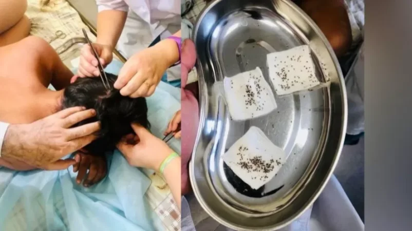 Մեղուների պարսը հարձակվել է 2 երեխայի վրա՝ նրանց խայթելով 465 անգամ. ՌԴ