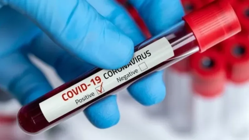 Առողջապահության նախարարությունը հրապարակել է Հայաստանում կորոնավիրուսային վարակի վերաբերյալ վերջին մեկ օրվա տվյալները