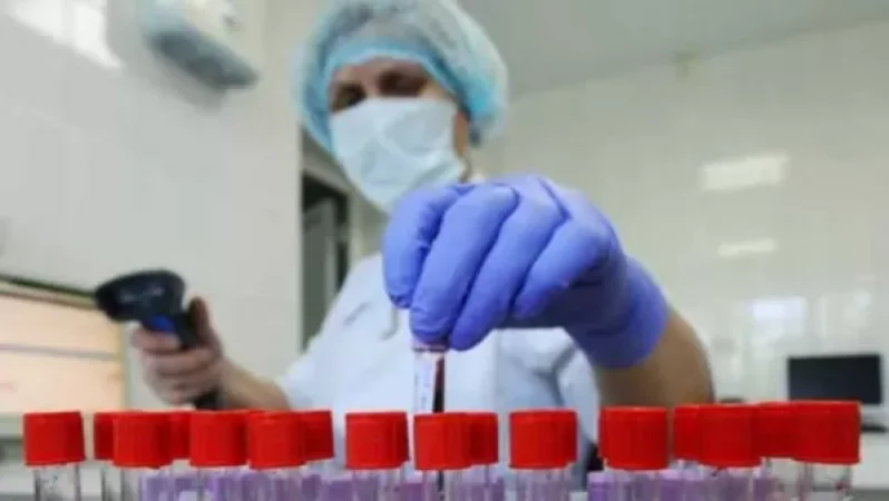 Հայաստանում կորոնավիրուսից ապաքինվել է 217 մարդ․ հաստատվել է վարակման 158 նոր դեպք