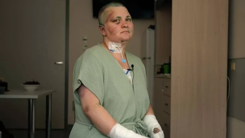 PHOTOS: Multiple Fractures, Closed Head Injury; Russian Journalist After Brutal Beating in Chechnya