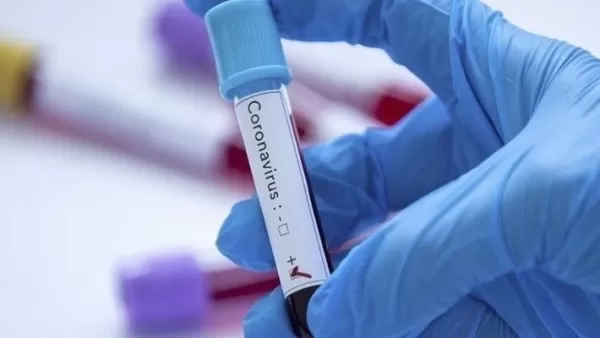 CՕVID19-ից գրանցված մահերն ու հաստատված նոր դեպքերն` այսօր