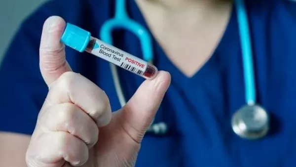 Կկորոնավիրուսով վարակման հաստատված դեպքերն՝ այսօր