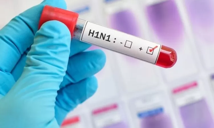 Հերթական մահացության դեպքը H1N1-ից. մահացողը երիտասարդ կին է