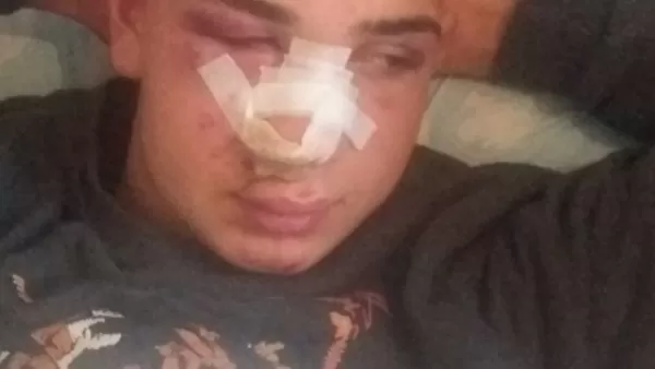 Թուրքիայում քուրդ երիտասարդը դաժան ծեծի է ենթարկվել ռասիստների կողմից