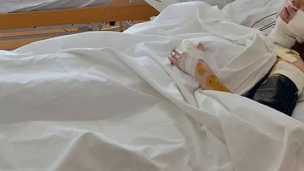 Գյումրիում ծեծի են ենթարկված երեխան ծայրահեղ ծանր վիճակում է
