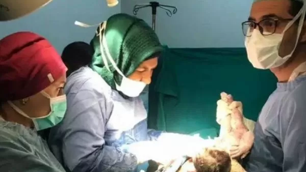 Սիրիայում հայ բժիշկը Հալեպի զինհոսպիտալում ծննդկանի ու նորածնի կյանքեր է փրկել