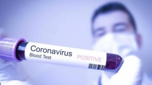 14 բուժաշխատակցի մոտ հաստատվել է կորոնավիրուսային հիվանդություն. նոր դեպքեր չեն. ԱՆ մամուլի խոսնակ