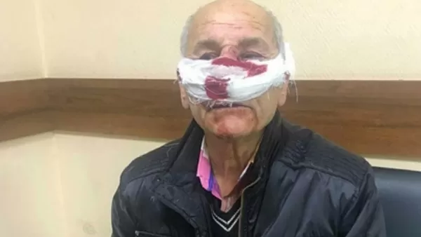 Սանկտ Պետերբուրգում շտապօգնության բժիշկը ծեծել է հայազգի 76-ամյա հիվանդին